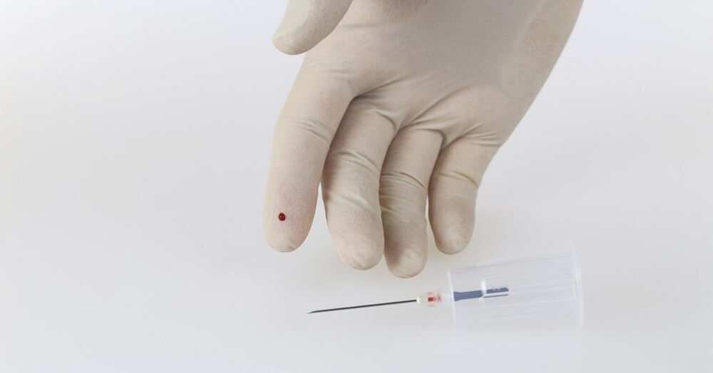 Needlestick Injuries (NSIs): Risks, Post-Exposure Measures, and Solutions